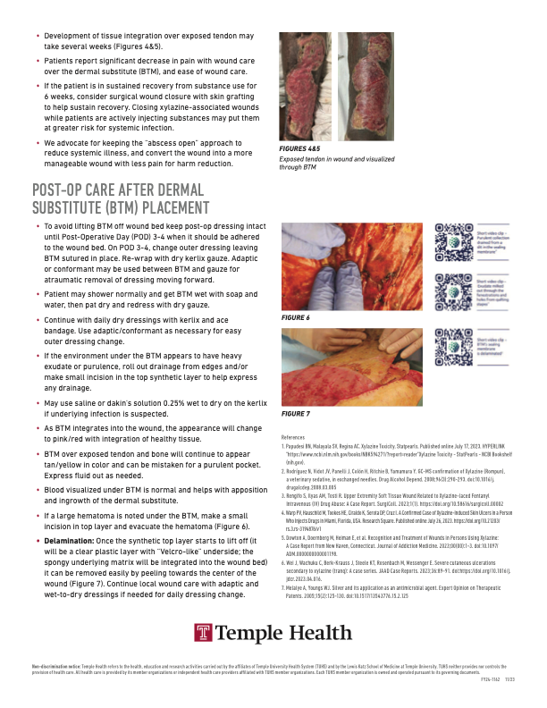 Guidelines for Xylazine-Associated Wounds by Temple Health, page 2 of 2: tissue integration, post-op care after dermal substitute (BTM) placement, and references